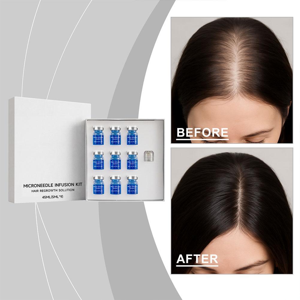Derma Roller 0.25 - 0.25 ミリメートルヘアエッセンシャルセラムマイクロニードルローラーセット毛包栄養頭皮ヘアケア髪を厚くするコンディショナーエッセンス